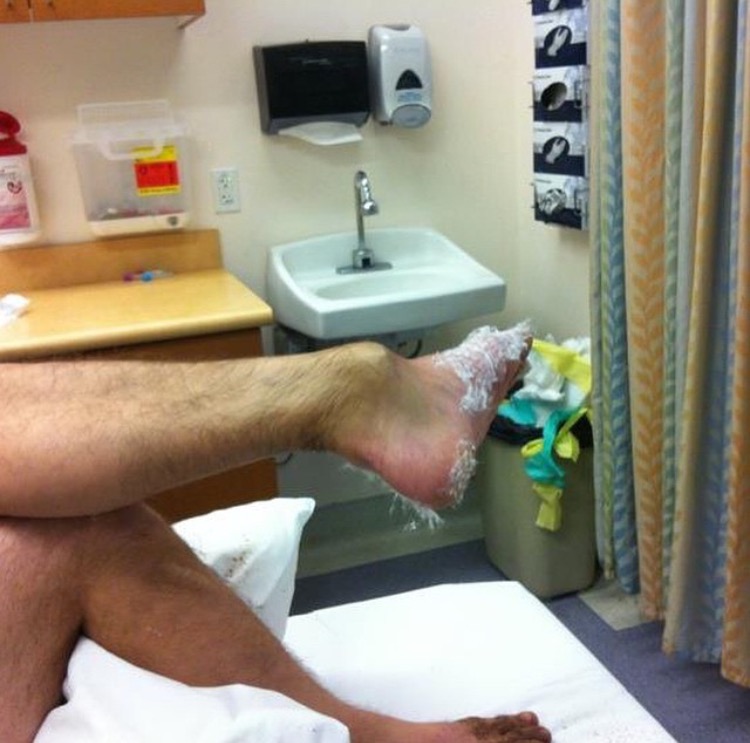 ankle.jpg